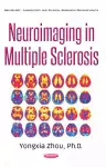 Neuroimaging in Multiple Sclerosis cover