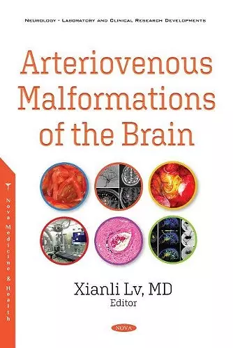 Arteriovenous Malformations of the Brain cover