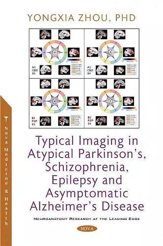 Typical Imaging in Atypical Parkinson's, Schizophrenia, Epilepsy and Asymptomatic Alzheimer's Disease cover