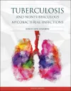 Tuberculosis and Nontuberculous Mycobacterial Infections cover