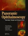 Panoramic Ophthalmoscopy cover