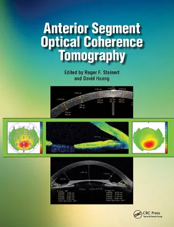 Anterior Segment Optical Coherence Tomography cover