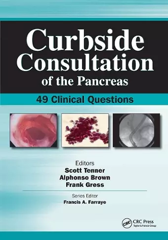 Curbside Consultation of the Pancreas cover