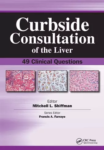 Curbside Consultation of the Liver cover