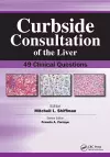 Curbside Consultation of the Liver cover