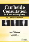 Curbside Consultation in Knee Arthroplasty cover