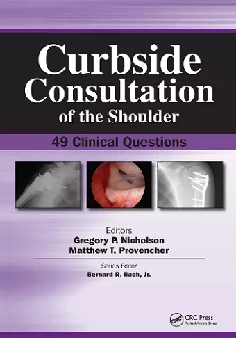 Curbside Consultation of the Shoulder cover