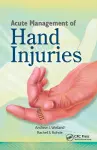 Acute Management of Hand Injuries cover