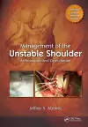 Management of the Unstable Shoulder cover