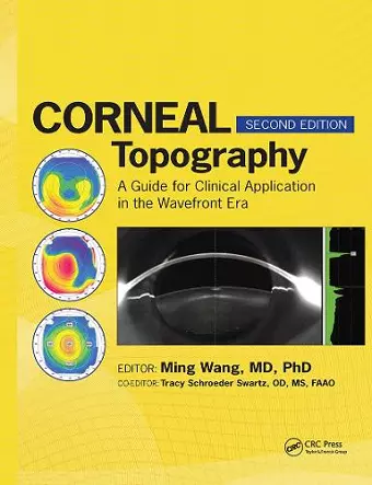 Corneal Topography cover