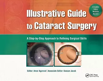 Illustrative Guide to Cataract Surgery cover