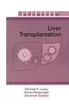 Liver Transplantation cover