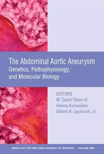 Abdominal Aortic Aneurysm cover