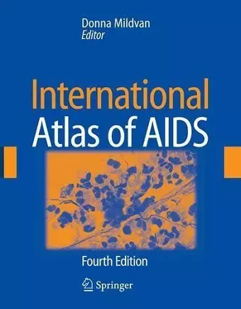 International Atlas of AIDS cover