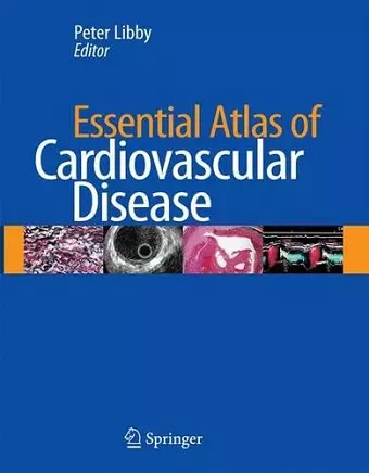 Essential Atlas of Cardiovascular Disease cover