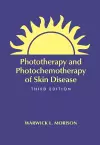 Phototherapy and Photochemotherapy for Skin Disease cover