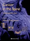 Cancer in the Spine cover