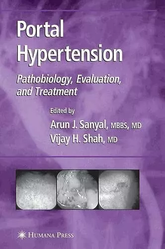 Portal Hypertension cover