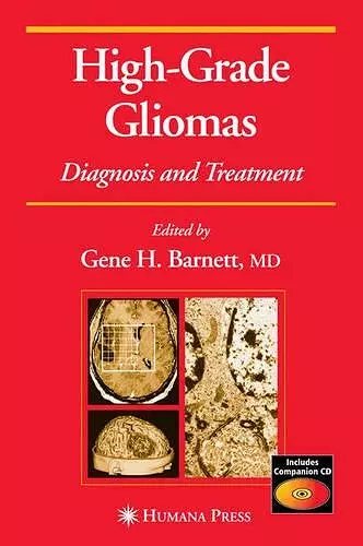 High-Grade Gliomas cover