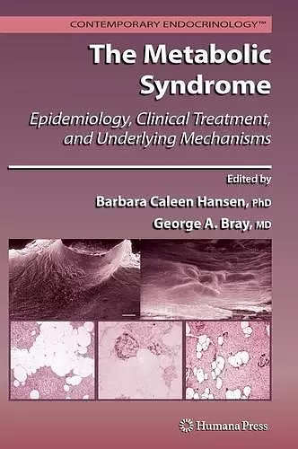 The Metabolic Syndrome: cover