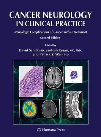 Cancer Neurology in Clinical Practice cover