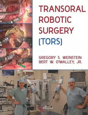 Transoral Robotic Surgery (TORS) cover