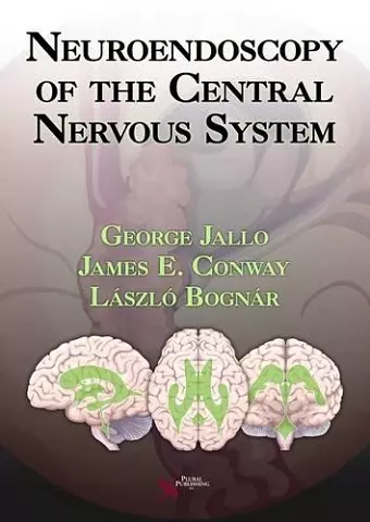 Neuroendoscopy of the Central Nervous System cover