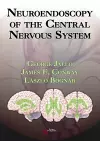 Neuroendoscopy of the Central Nervous System cover