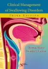 Clinical Management of Swallowing Disorders cover