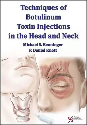 Techniques of Botulinum Toxin Injections in the Head and Neck cover