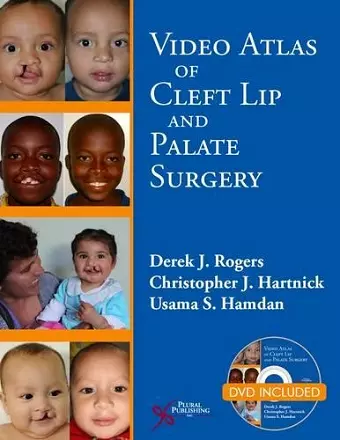 Video Atlas of Cleft Lip and  Palate Surgery cover