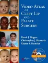 Video Atlas of Cleft Lip and  Palate Surgery cover