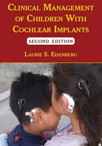 Clinical Management of Children with Cochlear Implants cover