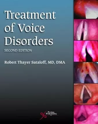 Treatment of Voice Disorders cover