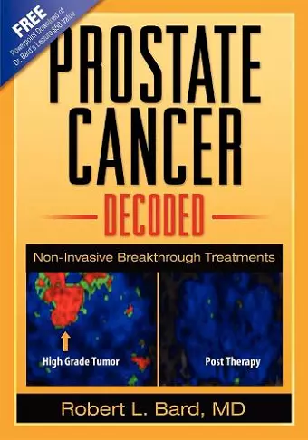 Prostate Cancer Decoded cover