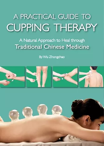 A Practical Guide to Cupping Therapy cover