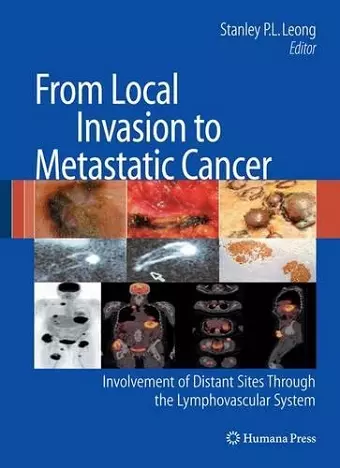 From Local Invasion to Metastatic Cancer cover