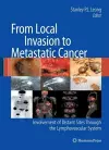 From Local Invasion to Metastatic Cancer cover