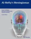 Al-Mefty's Meningiomas cover