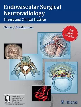 Endovascular Surgical Neuroradiology cover