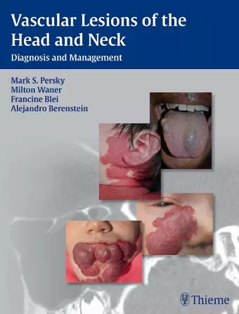 Vascular Lesions of the Head and Neck cover