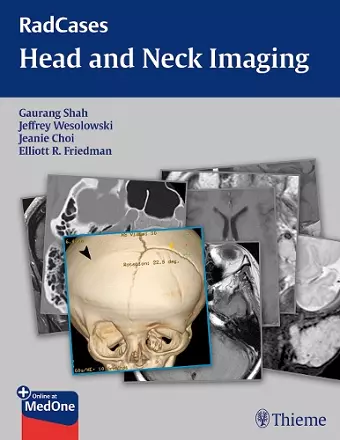 RadCases Head and Neck Imaging cover