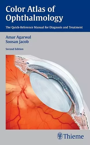 Color Atlas of Ophthalmology cover