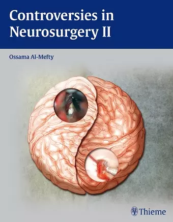 Controversies in Neurosurgery II cover