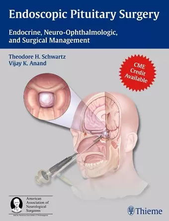 Endoscopic Pituitary Surgery cover