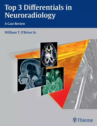 Top 3 Differentials in Neuroradiology cover