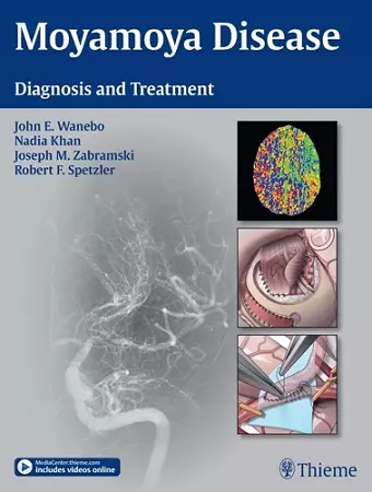 Moyamoya Disease cover