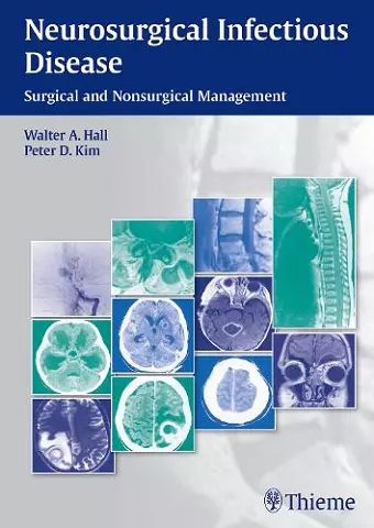 Neurosurgical Infectious Disease cover