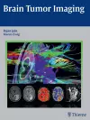 Brain Tumor Imaging cover