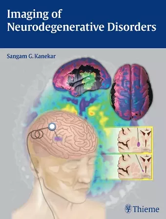 Imaging of Neurodegenerative Disorders cover